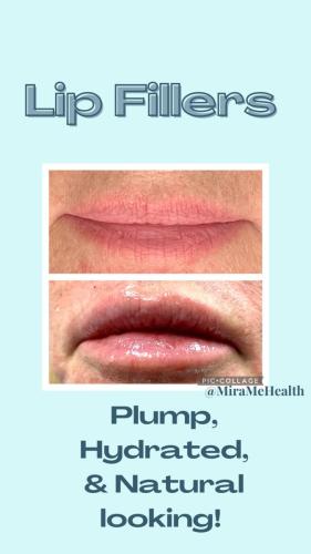 Lip Fillers Plump amp; Hydrated - 1
